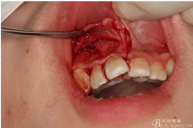 QQ圖片20150721155001.png QQ圖片20150721155001.png