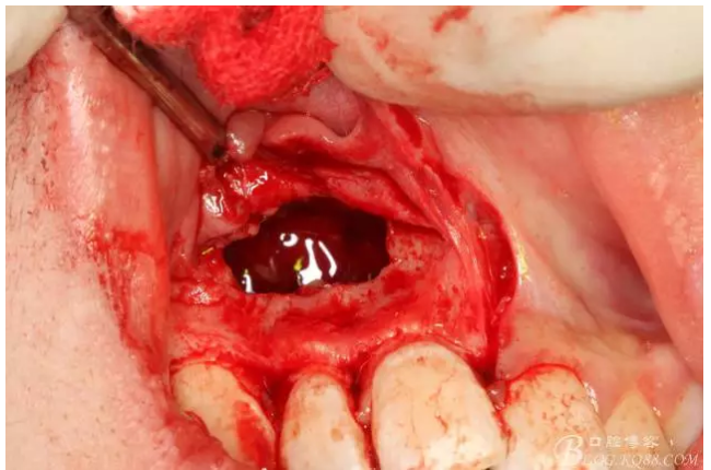 QQ圖片20150721155033.png QQ圖片20150721155033.png