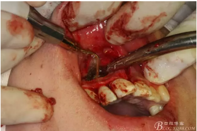 QQ圖片20150721155106.png QQ圖片20150721155106.png