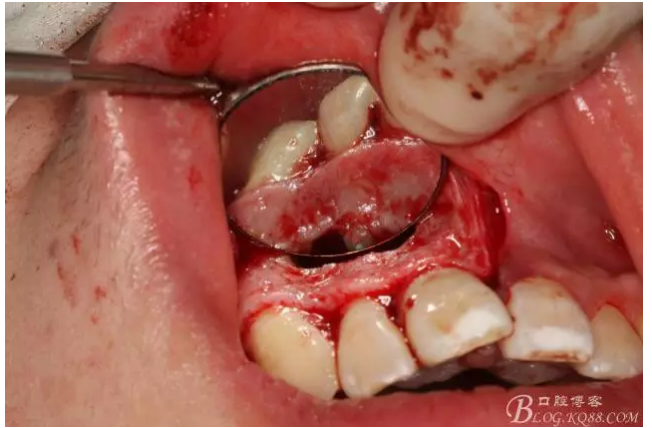 QQ圖片20150721155121.png QQ圖片20150721155121.png