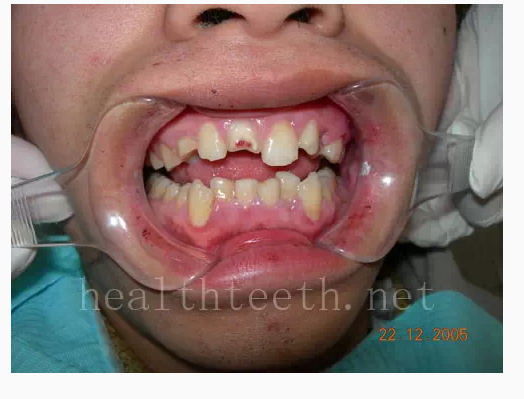 QQ圖片20150722094611.png QQ圖片20150722094611.png