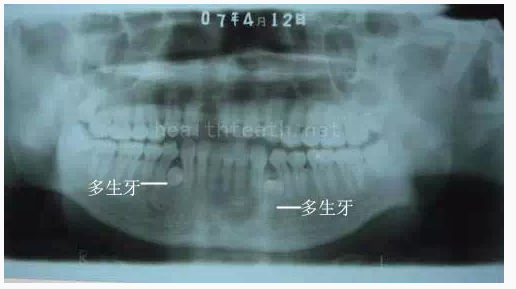 QQ圖片20150722094417.png QQ圖片20150722094417.png