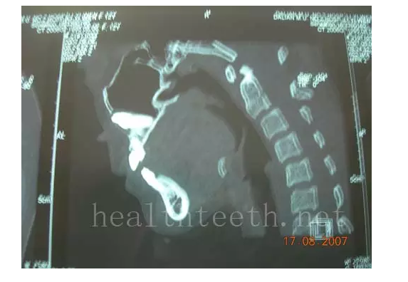 QQ圖片20150722094204.png QQ圖片20150722094204.png