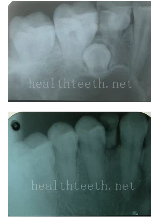 QQ圖片20150722093814.png QQ圖片20150722093814.png