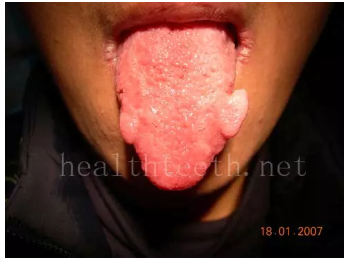 QQ圖片20150722093741.png QQ圖片20150722093741.png