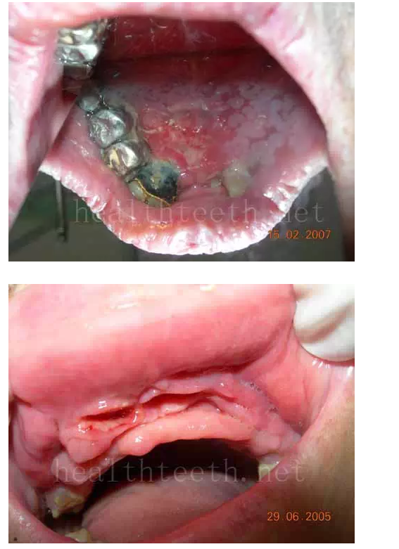 QQ圖片20150722093708.png QQ圖片20150722093708.png