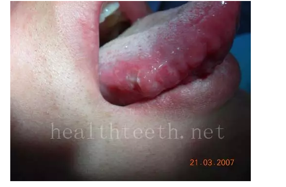 QQ圖片20150722093653.png QQ圖片20150722093653.png