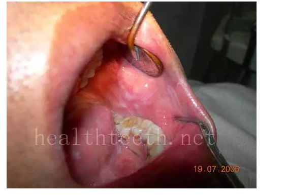 QQ圖片20150722093625.png QQ圖片20150722093625.png