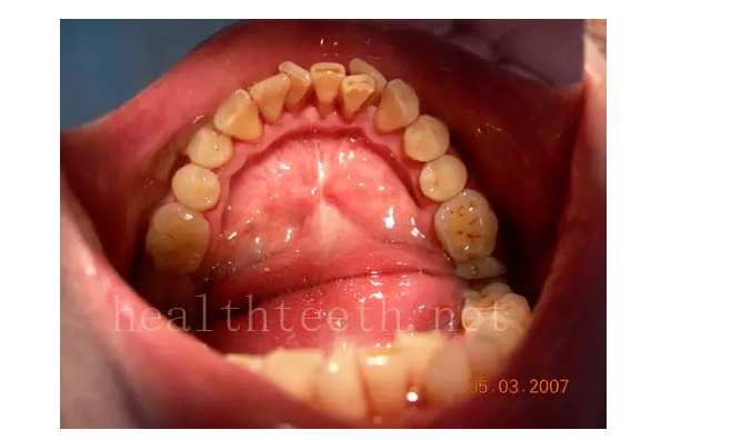 QQ圖片20150722093609.png QQ圖片20150722093609.png