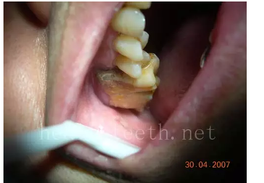 QQ圖片20150722093434.png QQ圖片20150722093434.png