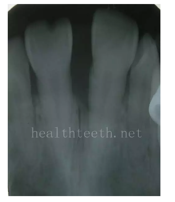 QQ圖片20150722093320.png QQ圖片20150722093320.png