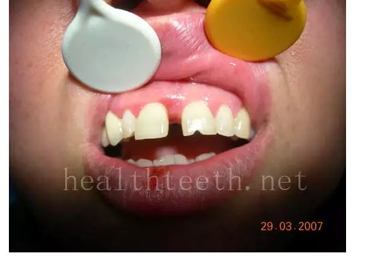 QQ圖片20150722093308.png QQ圖片20150722093308.png