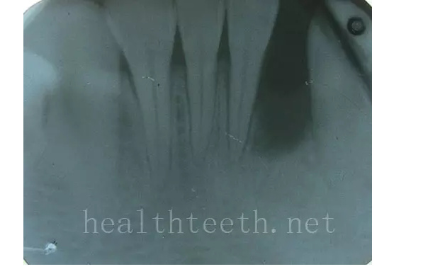 QQ圖片20150722093155.png QQ圖片20150722093155.png