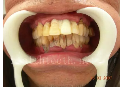 QQ圖片20150722093225.png QQ圖片20150722093225.png