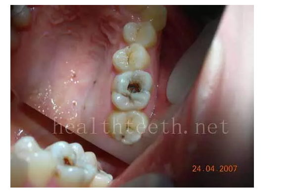 QQ圖片20150722092946.png QQ圖片20150722092946.png