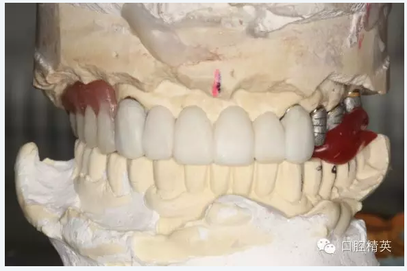 QQ圖片20150725092424.png QQ圖片20150725092424.png