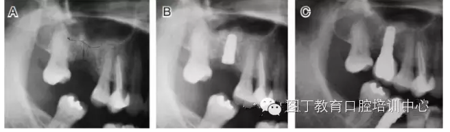 QQ圖片20150725105909.png QQ圖片20150725105909.png