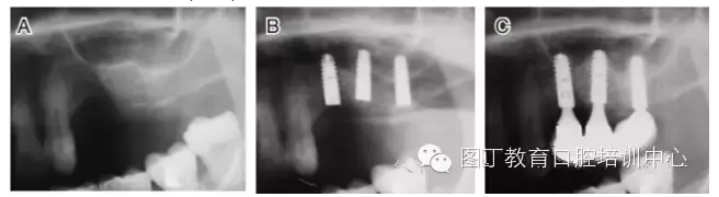 QQ圖片20150725105921.png QQ圖片20150725105921.png