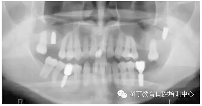 QQ圖片20150725110021.png QQ圖片20150725110021.png