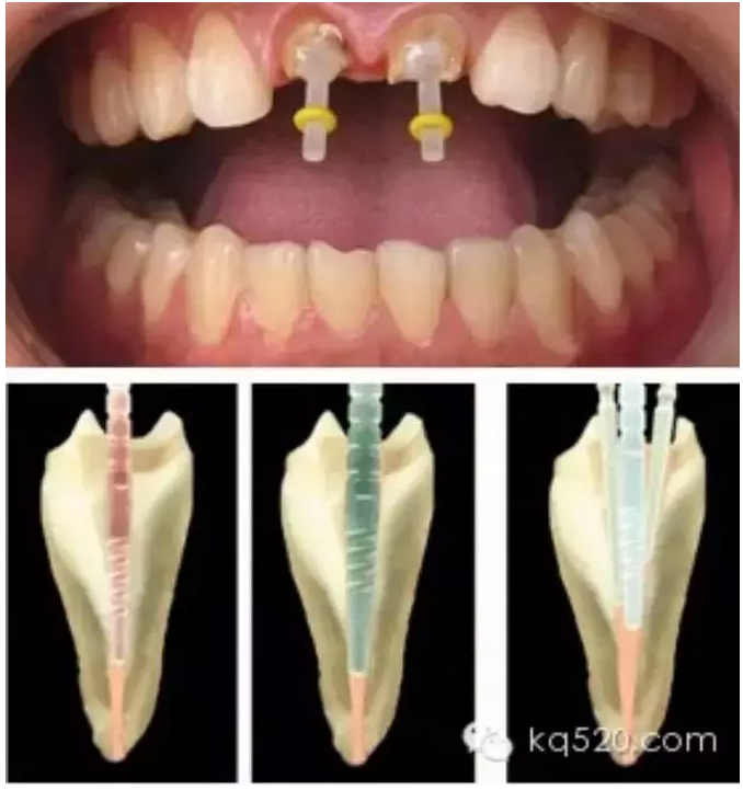 QQ圖片20150727133826.png QQ圖片20150727133826.png