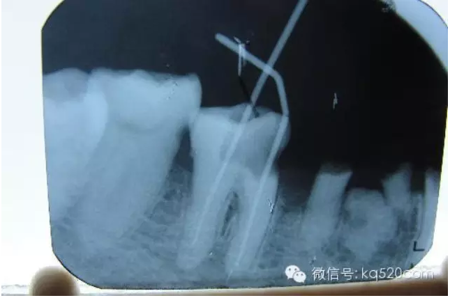 QQ圖片20150727133906.png QQ圖片20150727133906.png