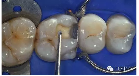 QQ圖片20150727134439.png QQ圖片20150727134439.png