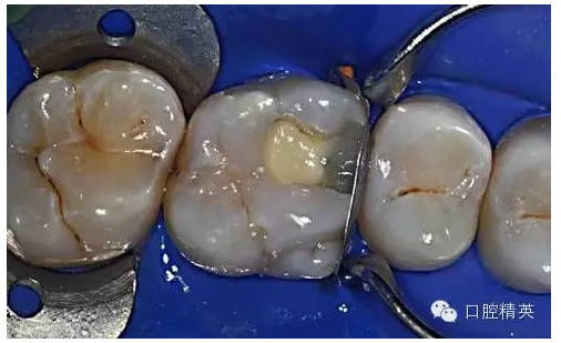 QQ圖片20150727134845.png QQ圖片20150727134845.png