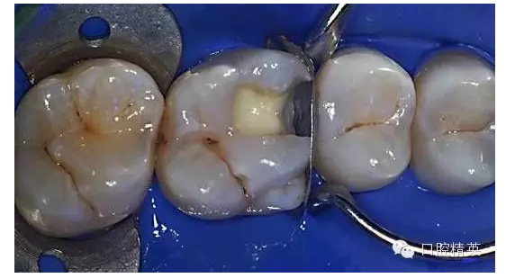 QQ圖片20150727134822.png QQ圖片20150727134822.png