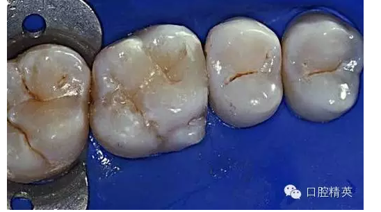 QQ圖片20150727135033.png QQ圖片20150727135033.png