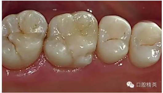 QQ圖片20150727135054.png QQ圖片20150727135054.png