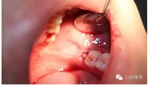 QQ圖片20150728093429.png QQ圖片20150728093429.png