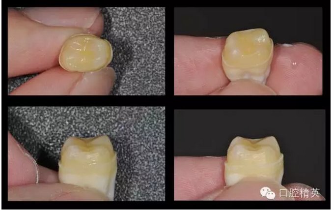 為什么你的牙齒備不好 為什么你的牙齒備不好