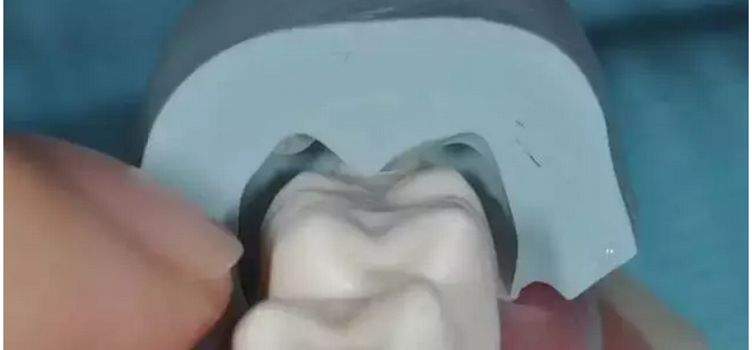 為什么你的牙齒備不好 為什么你的牙齒備不好