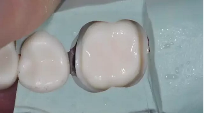 為什么你的牙齒備不好 為什么你的牙齒備不好