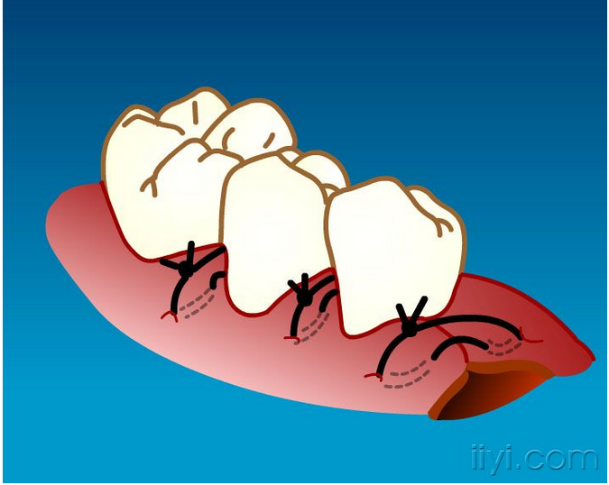 QQ圖片20150729104317.png QQ圖片20150729104317.png