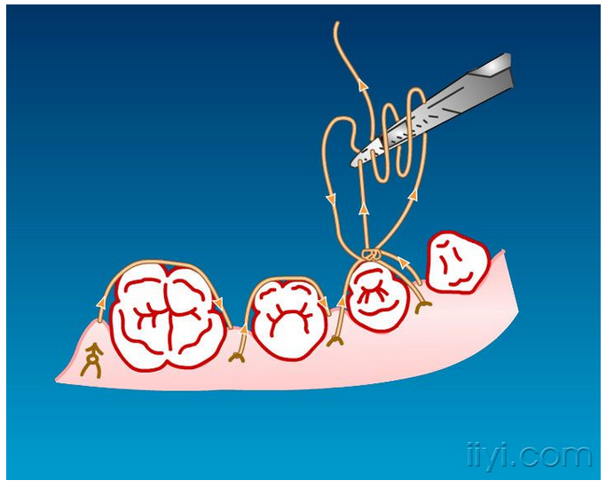 QQ圖片20150729104455.png QQ圖片20150729104455.png