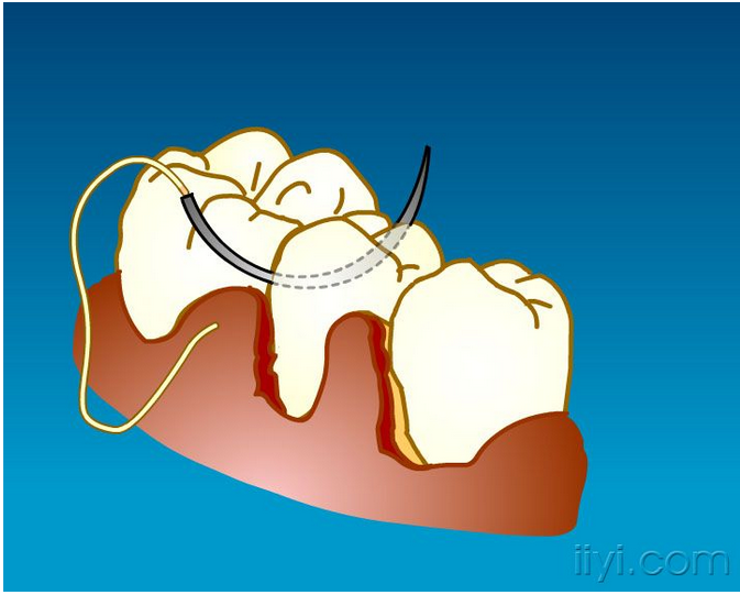 QQ圖片20150729104808.png QQ圖片20150729104808.png