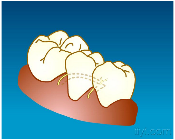 QQ圖片20150729104843.png QQ圖片20150729104843.png