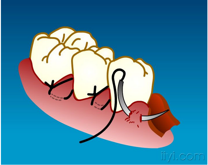 QQ圖片20150729104854.png QQ圖片20150729104854.png