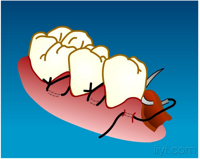 QQ圖片20150729104906.png QQ圖片20150729104906.png