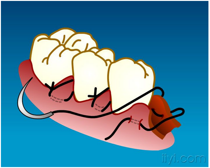 QQ圖片20150729104917.png QQ圖片20150729104917.png