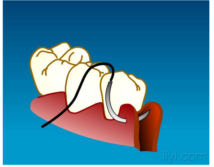 QQ圖片20150729104942.png QQ圖片20150729104942.png