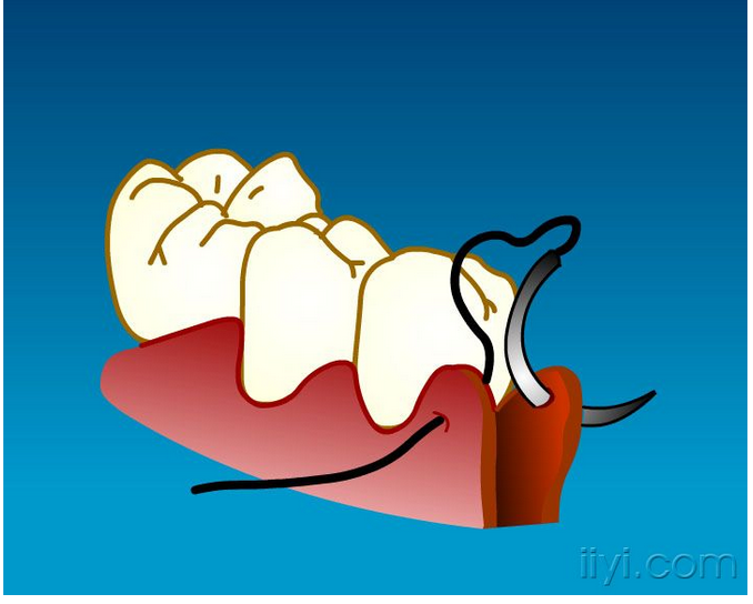 QQ圖片20150729105030.png QQ圖片20150729105030.png