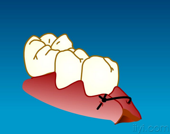 QQ圖片20150729105052.png QQ圖片20150729105052.png