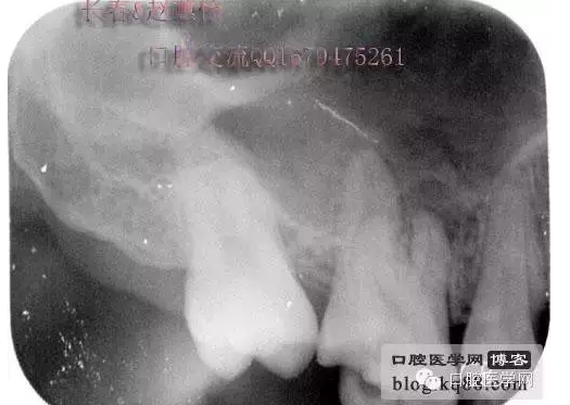 QQ圖片20150729144104.png QQ圖片20150729144104.png