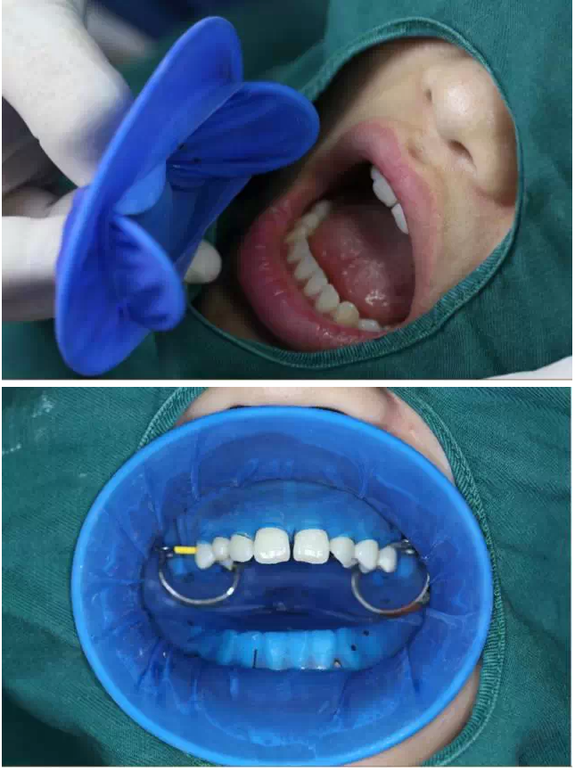 QQ圖片20150730101744.png QQ圖片20150730101744.png