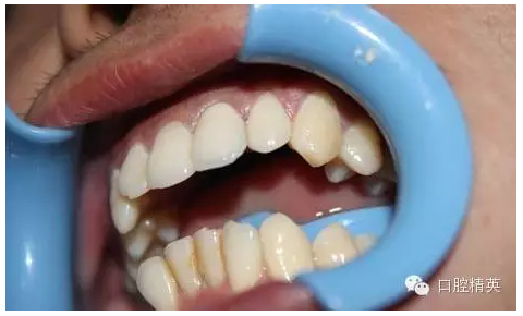 QQ圖片20150730113258.png QQ圖片20150730113258.png