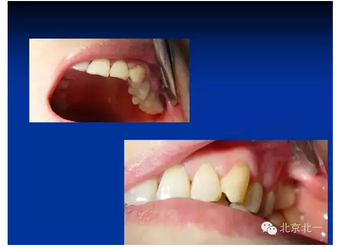 QQ圖片20150803112120.png QQ圖片20150803112120.png