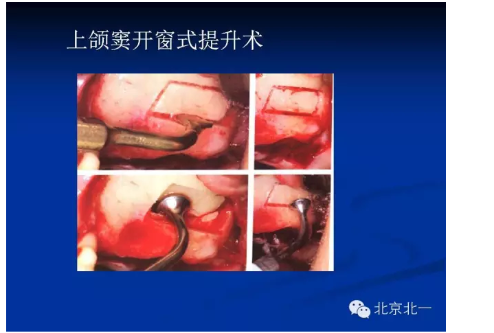 QQ圖片20150803112524.png QQ圖片20150803112524.png