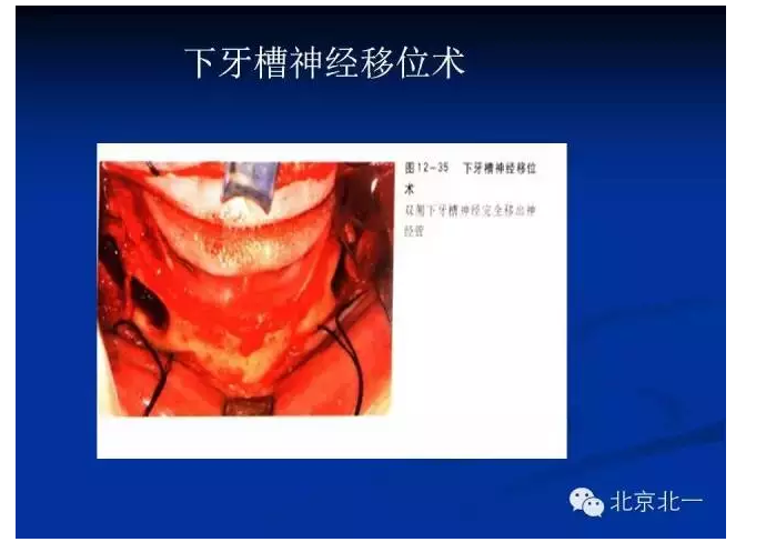 QQ圖片20150803112602.png QQ圖片20150803112602.png